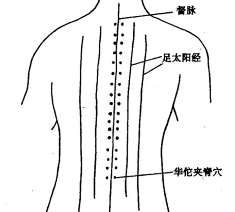 华佗夹脊穴.png